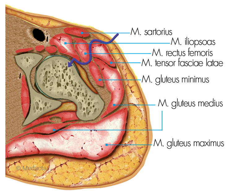 Anatomie einer Hüfte mit Muskeln und Knochen im Quertschnitt zur Darstellung der AMIS Methode